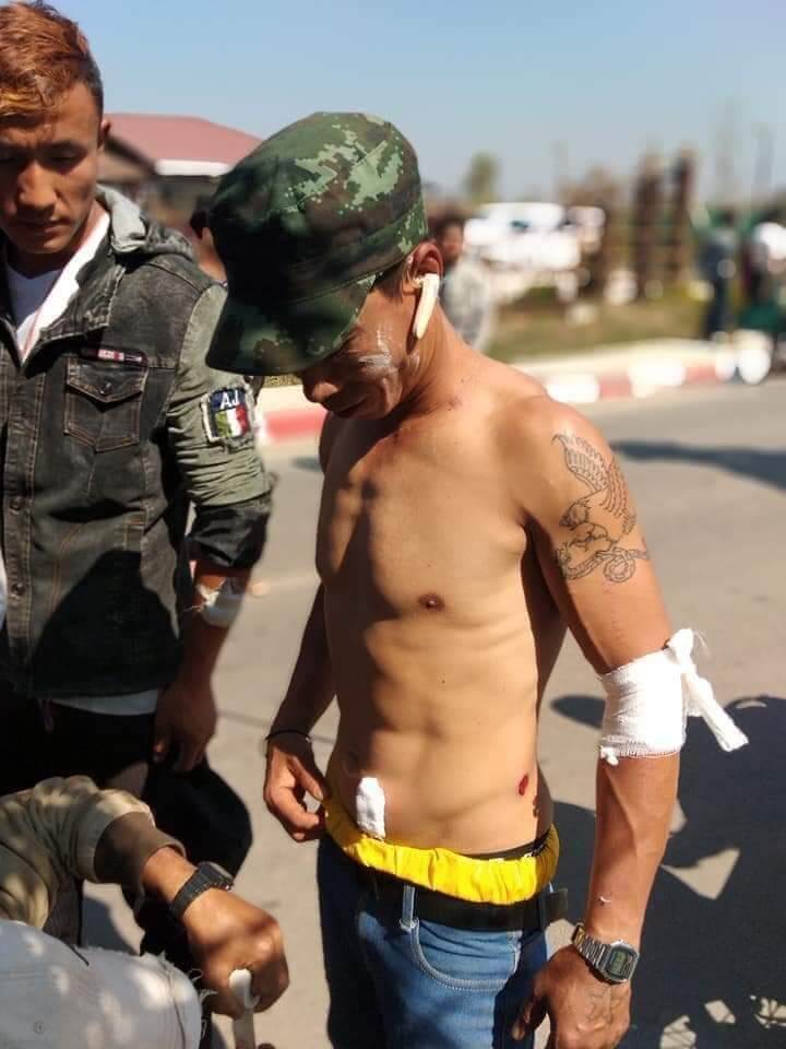 A protester receives medical treatment for injuries sustained from police actions in Loikaw. February 12, 2019. ©Progressive Karenni People Force